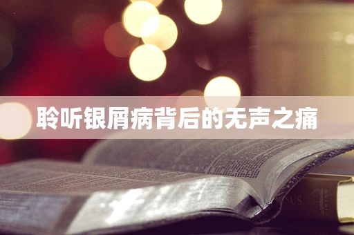 聆听银屑病背后的无声之痛